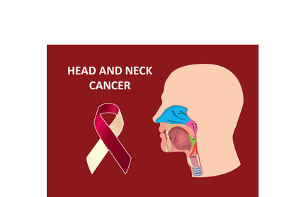 Head and neck cancers on the rise in India, youth at key risk — Experts